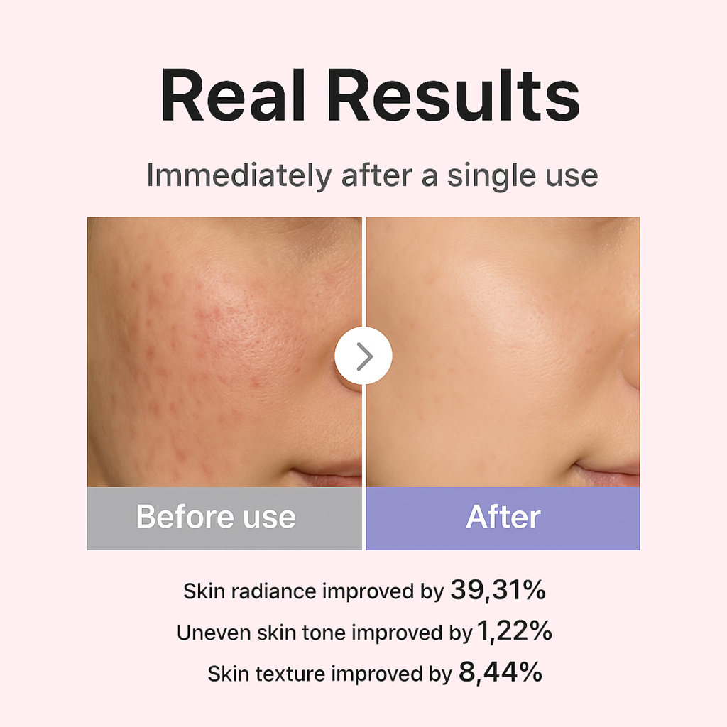 Beargli Radiant Pro